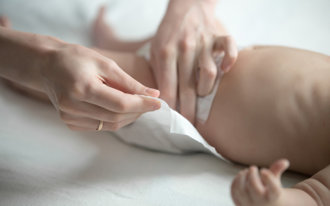 Windeldermatitis: Wunden Po des Babys behandeln.