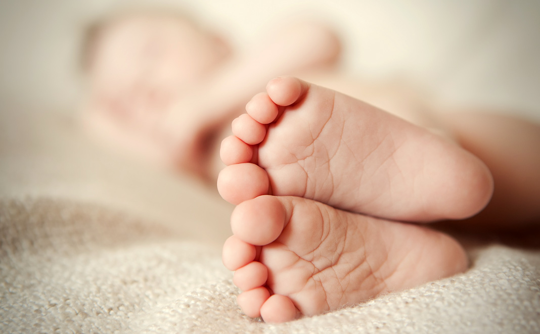 Klumpfuss beim Baby: Ursache und Therapie der Fussfehlbildung