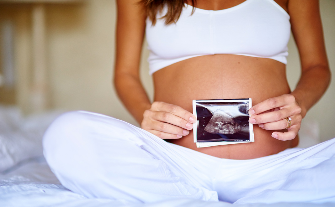 Checkliste Schwangerschaftsvorbereitung für das 1. bis 3. Trimester