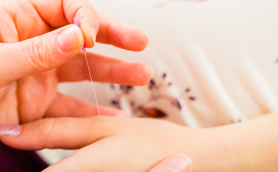 Kinderwunsch erfüllen durch Akupunktur