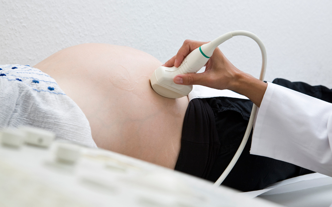 Anzahl Ultraschalluntersuchungen während Schwangerschaft.